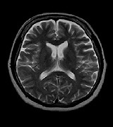 mri03